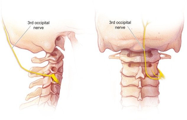 Occipital nerve pain anatomy and occipital neuralgia treatment in Jaipur