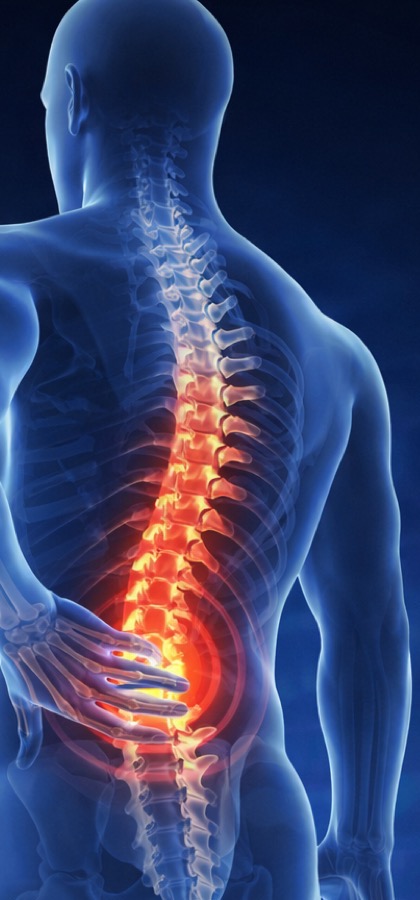 Back pain patient image for radiofrequency treatment for spine pain in Jaipur